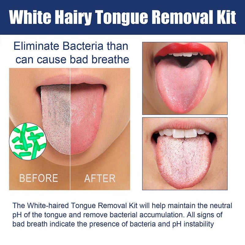 Tongue Cleaning Gel Set, Fresh Mint Tongue Cleaning Paste, Bad Breath and Halitosis, Mouth Odor Eliminator, Easy to Use Tongue Scraper, Use with Tongue Brushes - Image 3